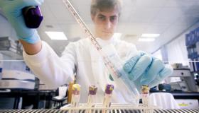 دراسة ” فيروس الورم الحليمي البشري”يمكن ان يؤدي إلى سرطان البروستاتا