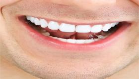 وصفات تبييض الأسنان في دقائق.. وصفات طبيعية لبياض الأسنان