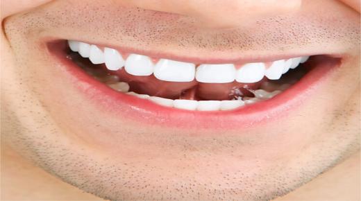 وصفات تبييض الأسنان في دقائق.. وصفات طبيعية لبياض الأسنان